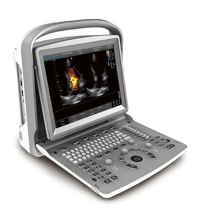 HLECO6 Laptop color doppler Ultrasound System