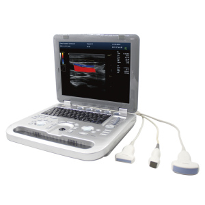 HLHUC-560 Color Doppler Ultrasound diagnostic device