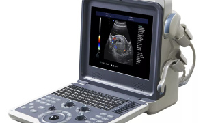 HLHUC-350 Hand-carried 4D Color doppler Ultrasound Diagnostic System