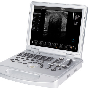 HLHUC-250PD 4D Laptop color doppler machine