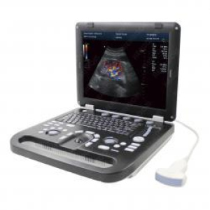 HLHUC-570 Color Doppler Ultrasound diagnostic device