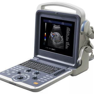 HLHUC-300 Hand-carried 4D Color Ultrasound Diagnostic System