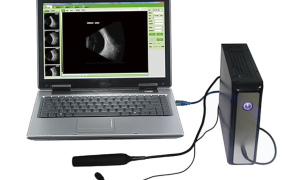 HLHO-200 Ophthalmic A/B Ultrasound box scanner